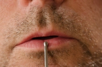 Suction method Suction method